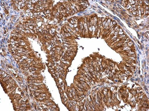 MMP2 Antibody in Immunohistochemistry (Paraffin) (IHC (P))