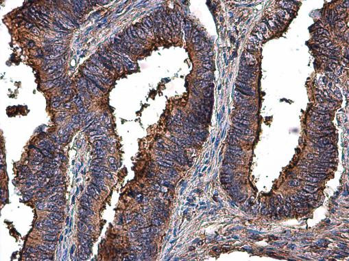 MMP2 Antibody in Immunohistochemistry (Paraffin) (IHC (P))