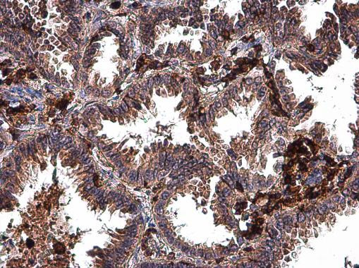 MMP2 Antibody in Immunohistochemistry (Paraffin) (IHC (P))