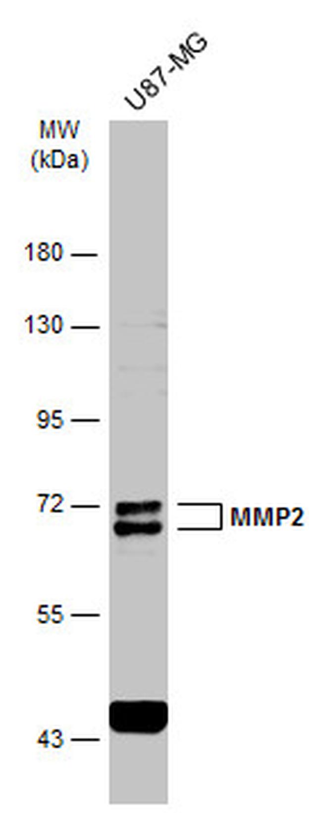 MMP2 Antibody in Western Blot (WB)