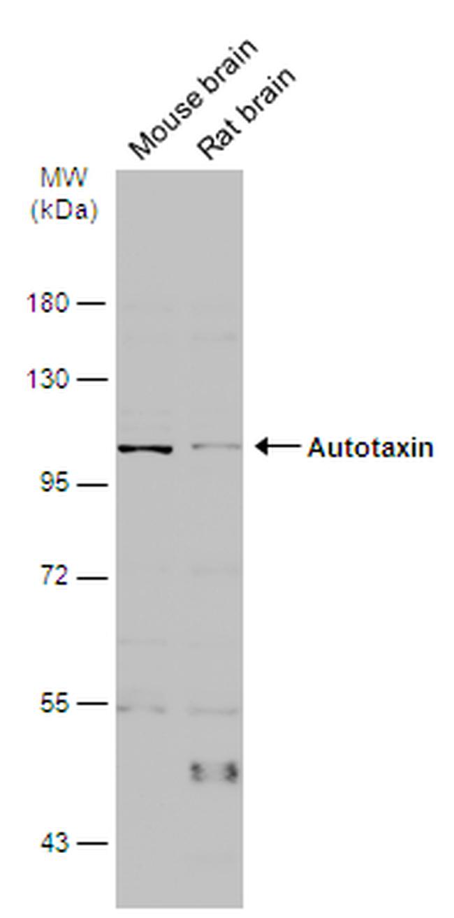 ENPP2 Antibody in Western Blot (WB)