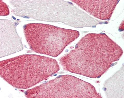 TAZ Antibody in Immunohistochemistry (Paraffin) (IHC (P))