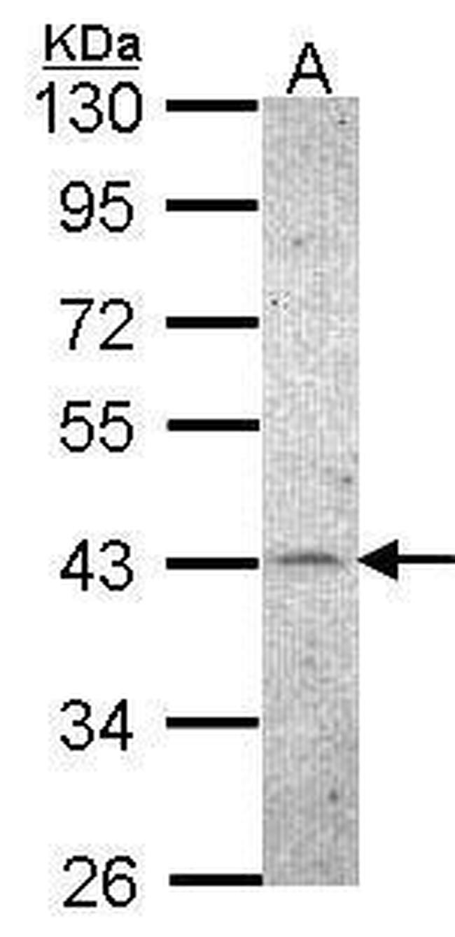 CK2 alpha-1 Antibody in Western Blot (WB)