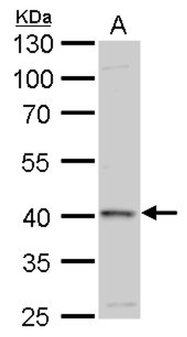 GALK1 Antibody in Western Blot (WB)