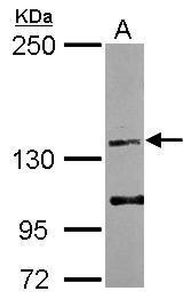 EGF Antibody in Western Blot (WB)
