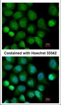 CASK Antibody in Immunocytochemistry (ICC/IF)