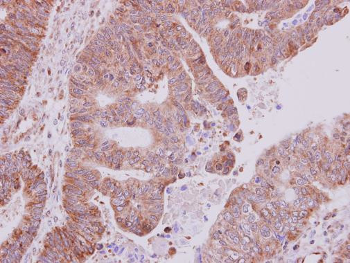 AKT2 Antibody in Immunohistochemistry (Paraffin) (IHC (P))