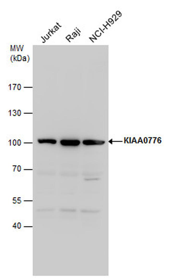 UFL1 Antibody in Western Blot (WB)