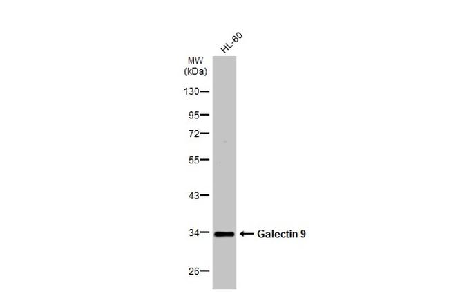 Galectin 9 Antibody in Western Blot (WB)