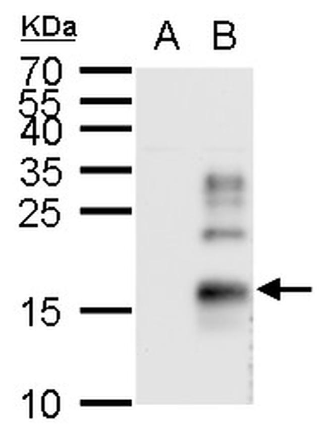 TGF alpha Antibody in Western Blot (WB)