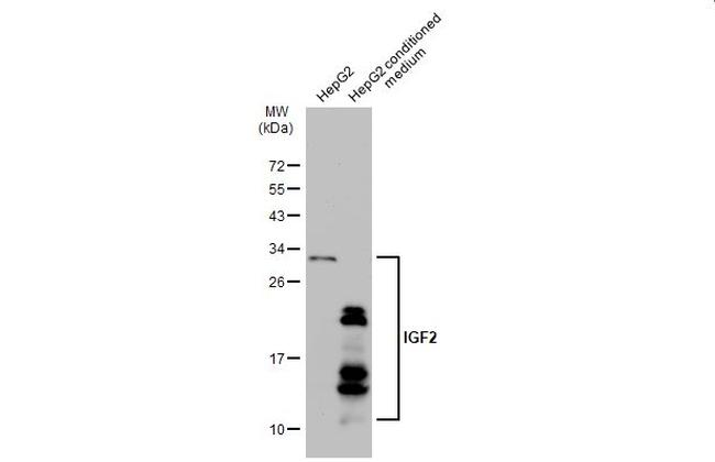 IGF2 Antibody in Western Blot (WB)