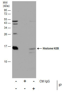 Histone H2B Antibody in Immunoprecipitation (IP)