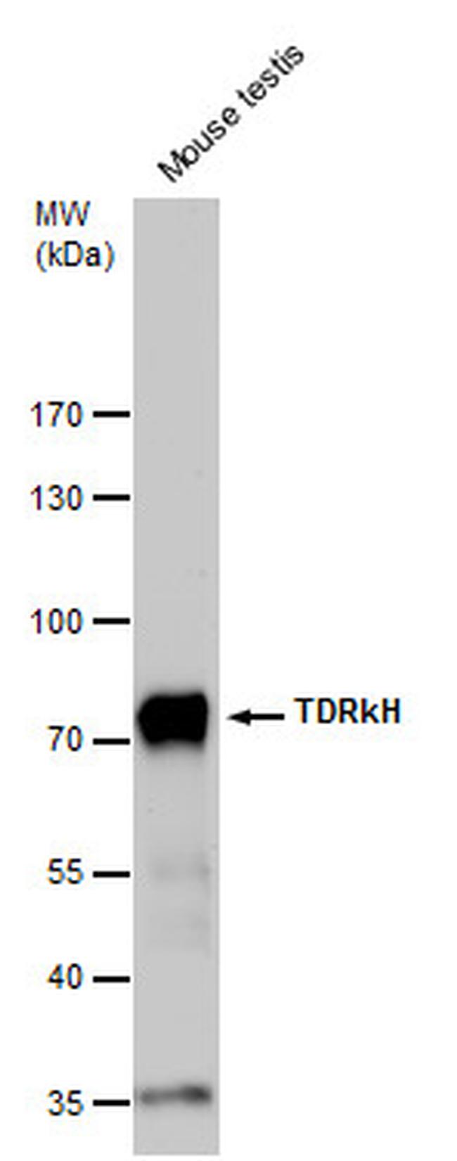 TDRKH Antibody in Western Blot (WB)