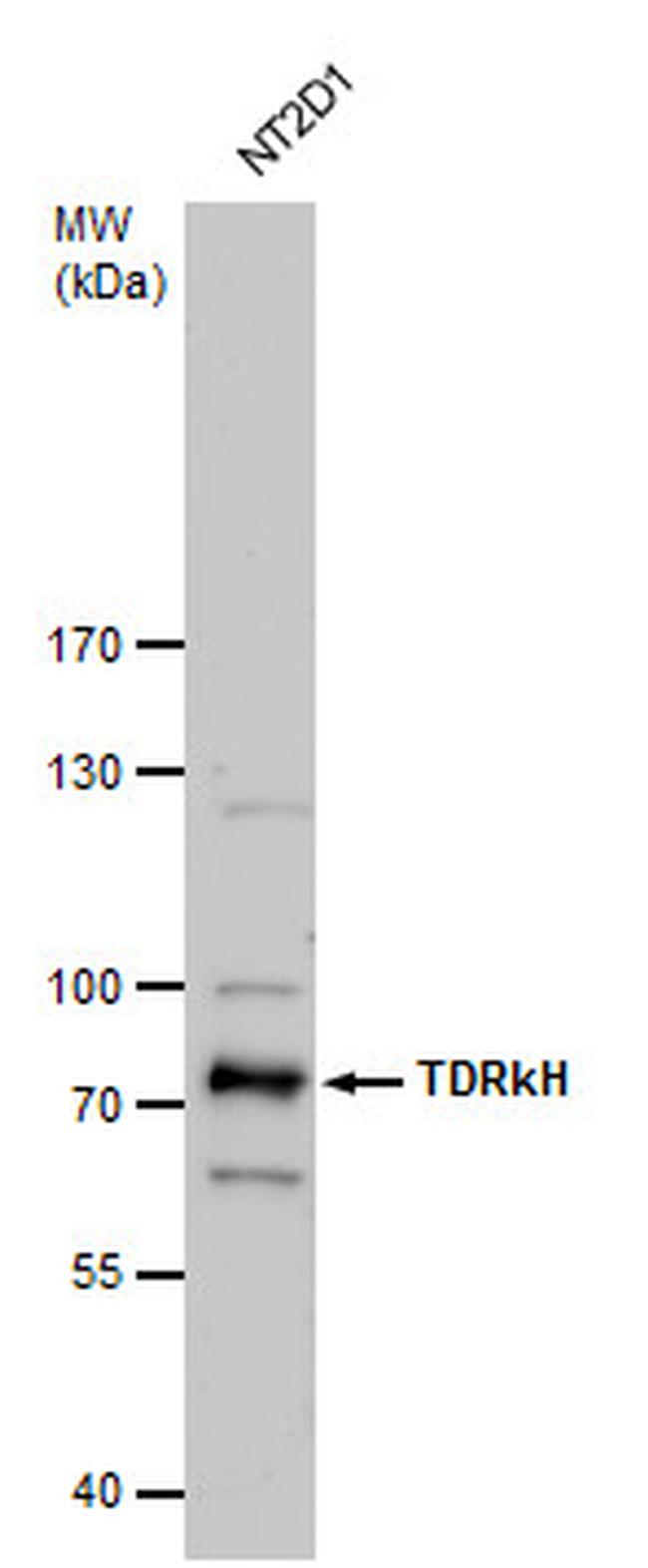 TDRKH Antibody in Western Blot (WB)