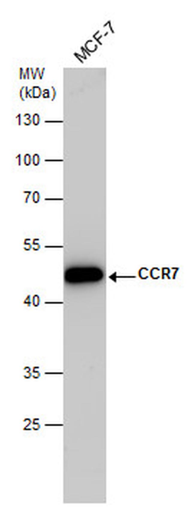 CCR7 Polyclonal Antibody (PA5-85613)