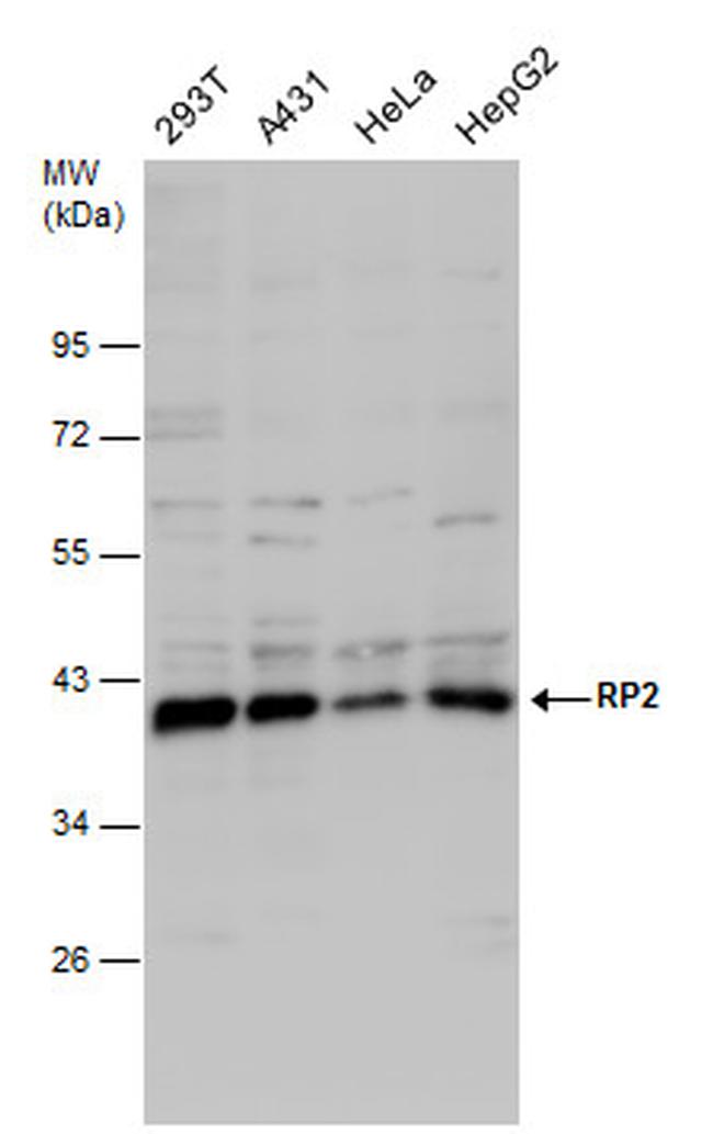 RP2 Antibody in Western Blot (WB)