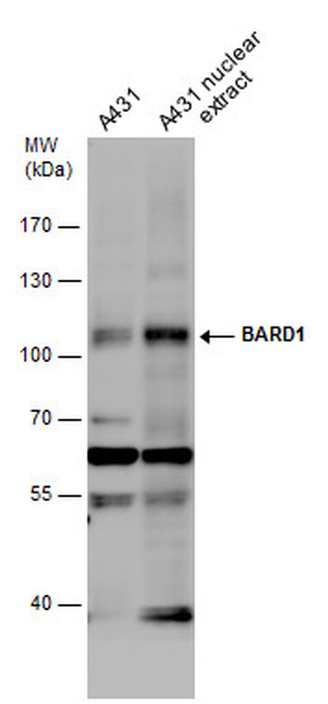 BARD1 Antibody in Western Blot (WB)