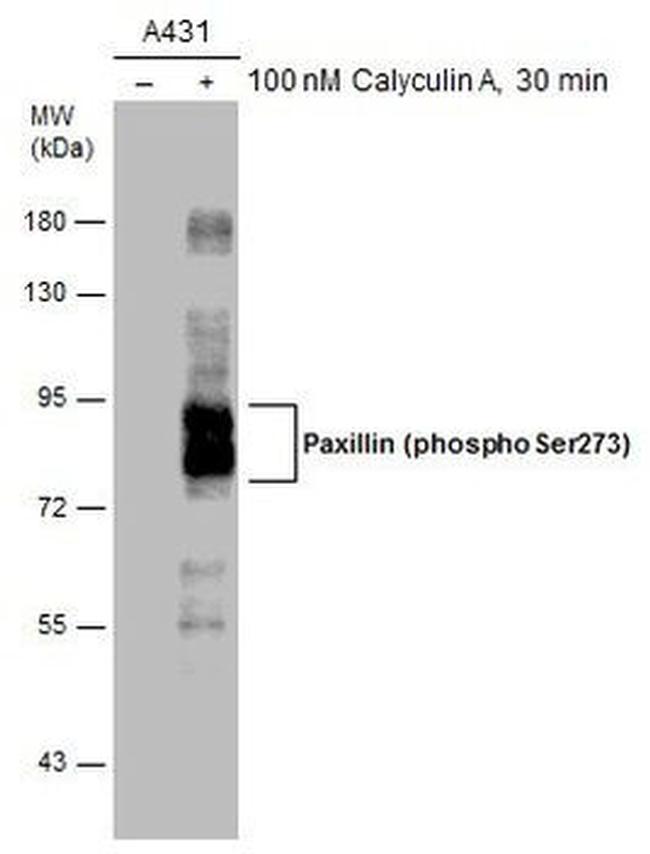 Phospho-Paxillin (Ser273) Antibody in Western Blot (WB)