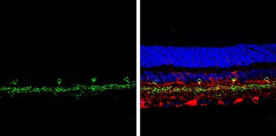 VGLUT3 Antibody in Immunohistochemistry (Paraffin) (IHC (P))