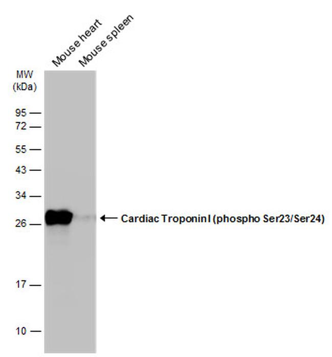 Phospho-Cardiac Troponin I (Ser23, Ser24) Antibody in Western Blot (WB)