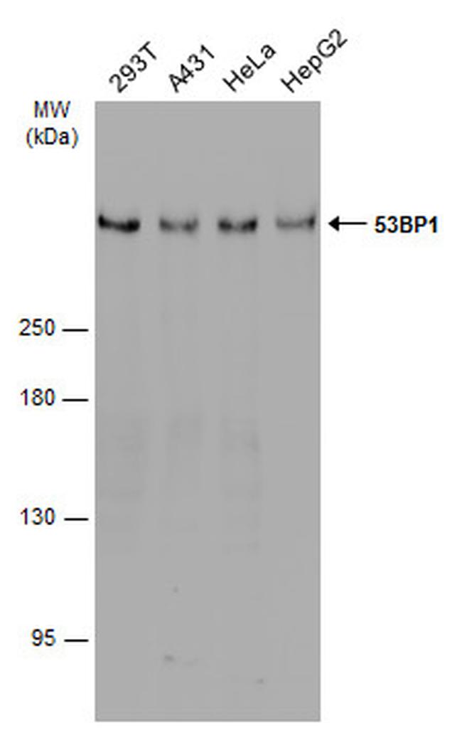 53BP1 Antibody in Western Blot (WB)