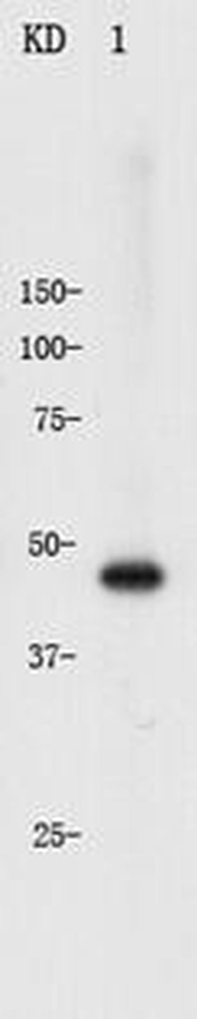 Cytokeratin 17 Antibody in Western Blot (WB)