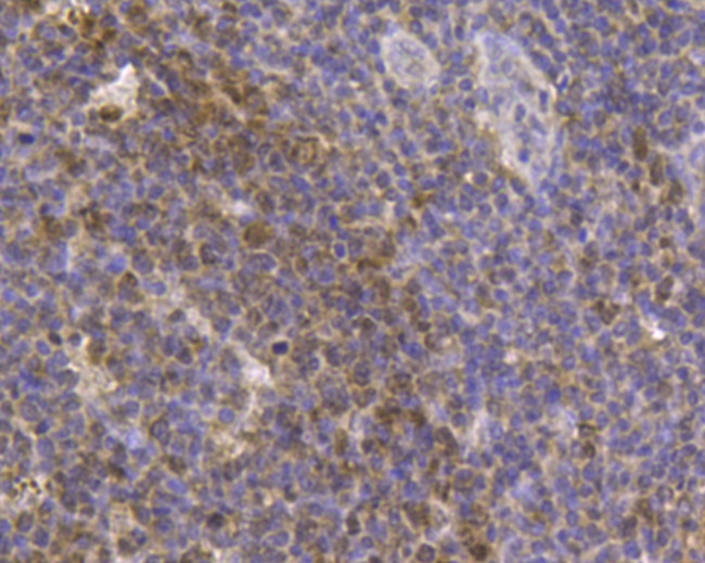 CD80 (B7-1) Antibody in Immunohistochemistry (Paraffin) (IHC (P))