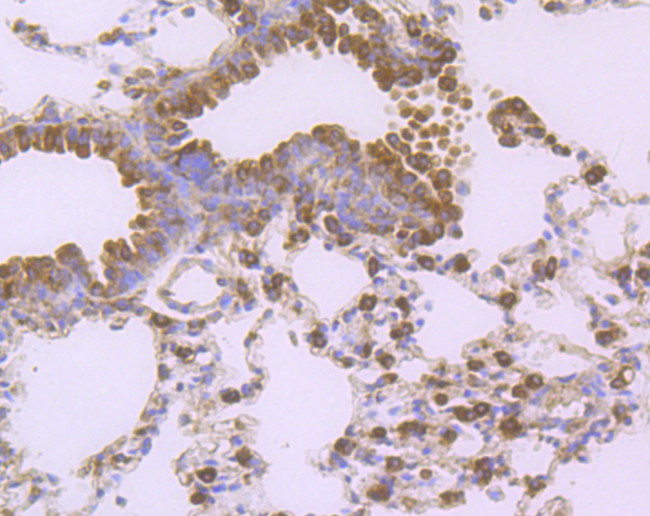 CD80 (B7-1) Antibody in Immunohistochemistry (Paraffin) (IHC (P))