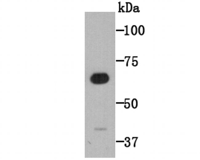 CD80 (B7-1) Antibody in Western Blot (WB)