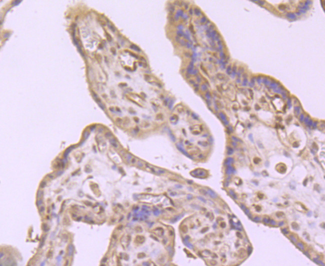 CD61 (Integrin beta 3) Antibody in Immunohistochemistry (Paraffin) (IHC (P))