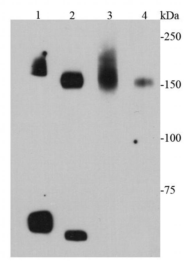c-Met Antibody in Western Blot (WB)