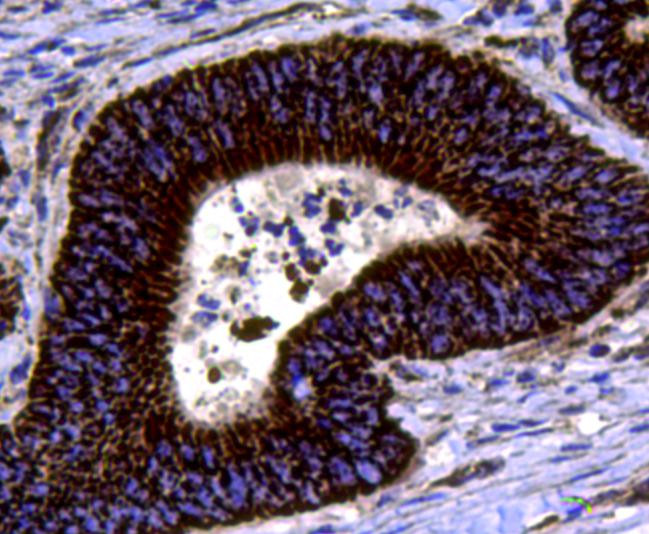 Chromogranin A Polyclonal Antibody (PA5-85952)