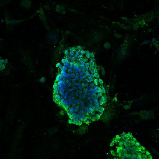 DPY30 Antibody in Immunocytochemistry (ICC/IF)