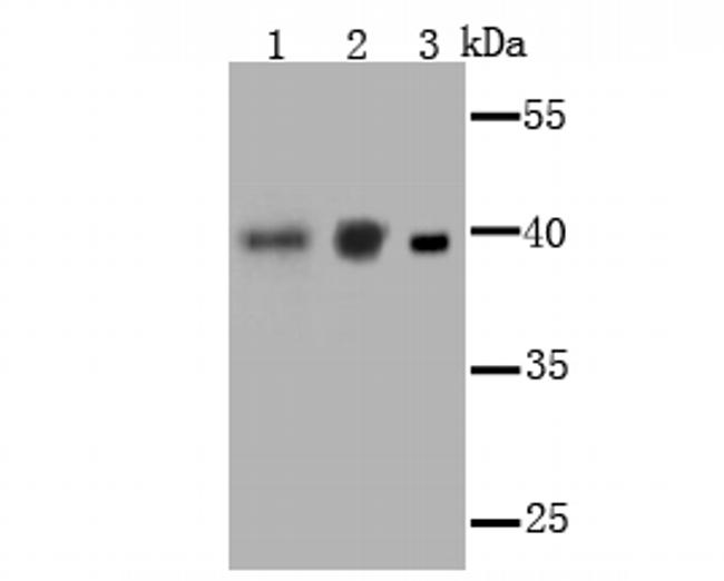 PCBP1 Antibody in Western Blot (WB)