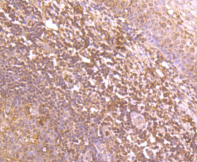 IKK beta Antibody in Immunohistochemistry (Paraffin) (IHC (P))