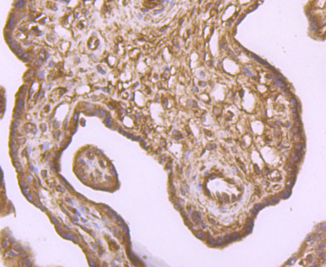 IKK beta Antibody in Immunohistochemistry (Paraffin) (IHC (P))