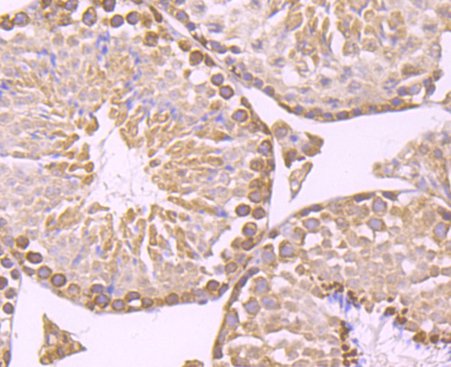 IKK beta Antibody in Immunohistochemistry (Paraffin) (IHC (P))