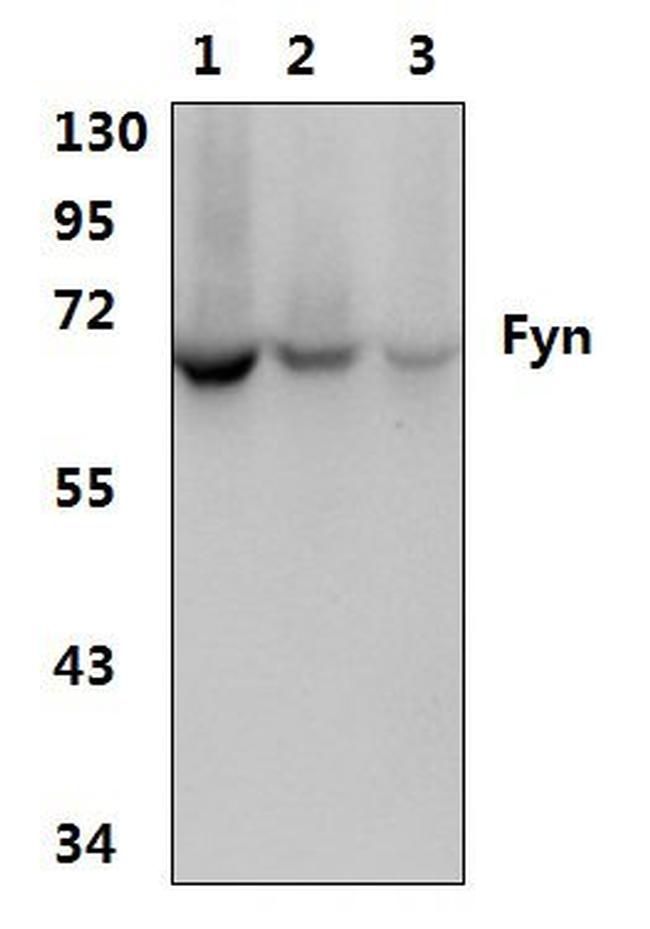 Fyn Antibody in Western Blot (WB)