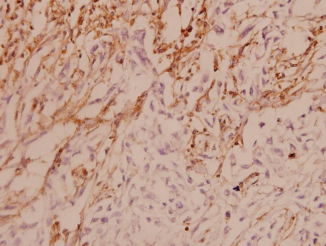 ASK1 Antibody in Immunohistochemistry (Paraffin) (IHC (P))