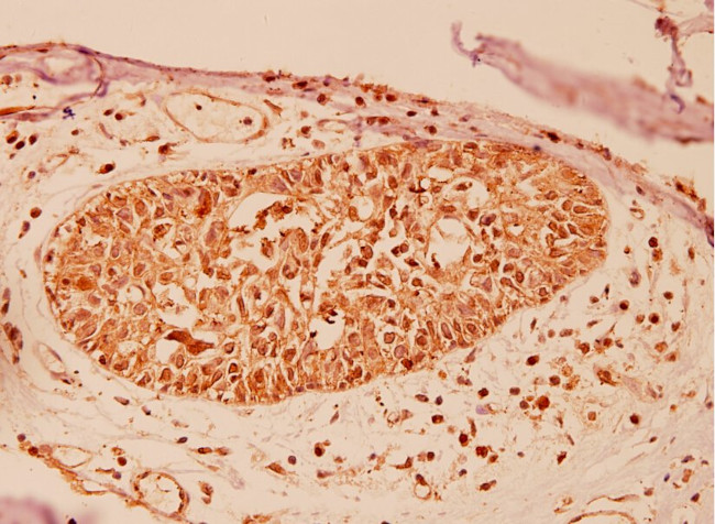 DJ-1 Antibody in Immunohistochemistry (Paraffin) (IHC (P))