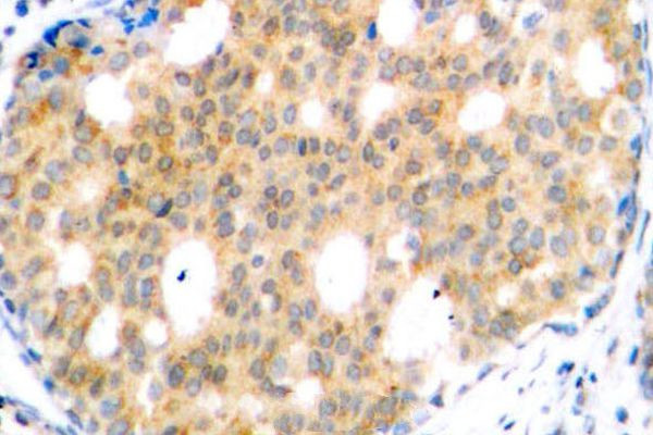 GSK3B Antibody in Immunohistochemistry (Paraffin) (IHC (P))