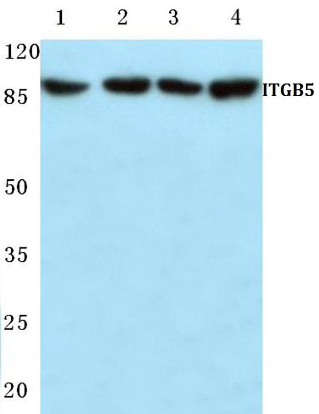 ITGB5 Antibody in Western Blot (WB)