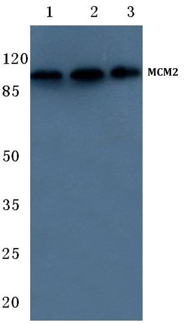 MCM2 Antibody in Western Blot (WB)