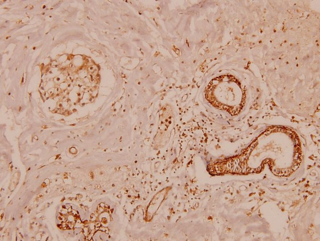 MMP11 Antibody in Immunohistochemistry (Paraffin) (IHC (P))