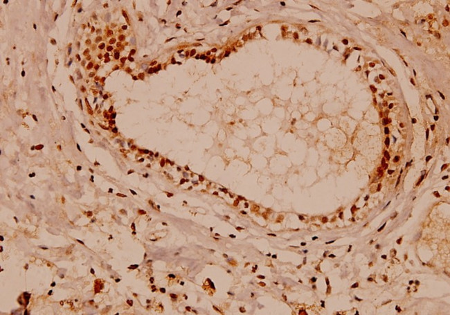 ATP1A1 Antibody in Immunohistochemistry (Paraffin) (IHC (P))