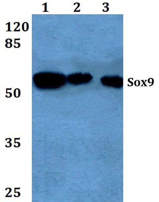 sox9-polyclonal-antibody-pa5-86301