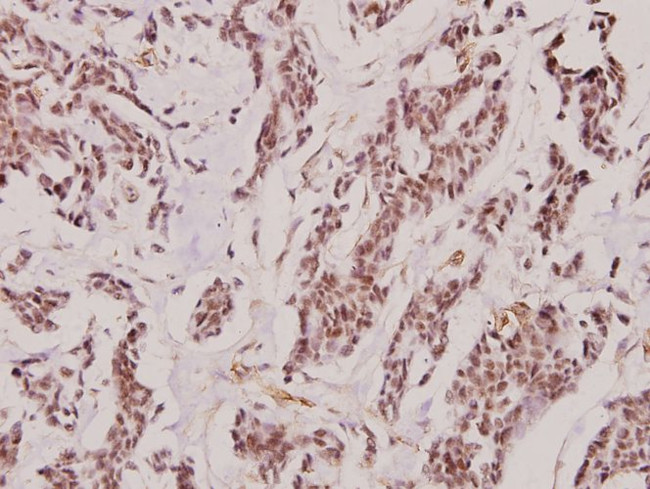 CD122 Antibody in Immunohistochemistry (Paraffin) (IHC (P))