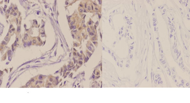 CK2 alpha-1 Antibody in Immunohistochemistry (Paraffin) (IHC (P))