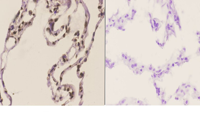 HMGB1 Antibody in Immunohistochemistry (Paraffin) (IHC (P))