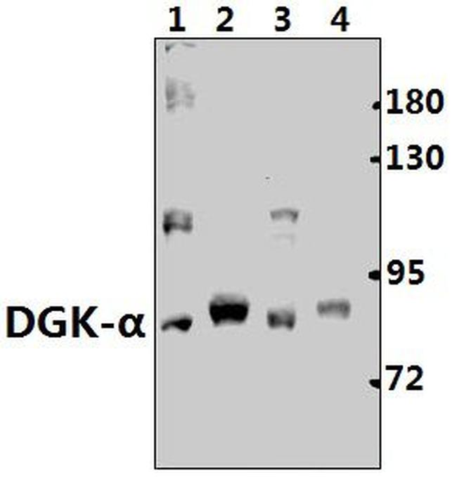 DGKA Antibody in Western Blot (WB)